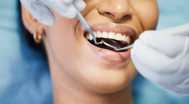 Best Emergency Wisdom Tooth Extraction in Wind Gap, PA