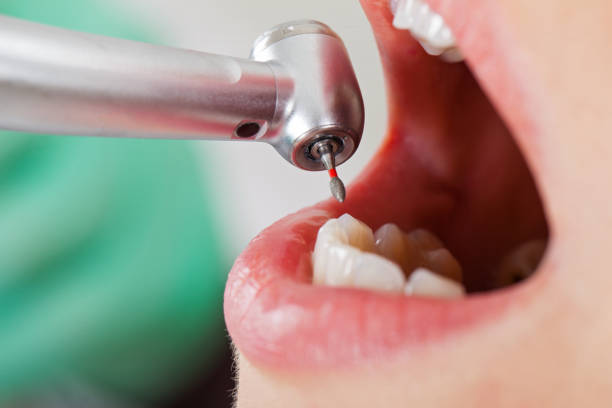Best Broken or Chipped Tooth Repair in Wind Gap, PA